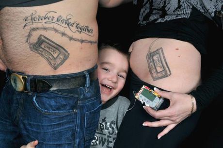 parents got insulinpump tattoos to support diabetic child